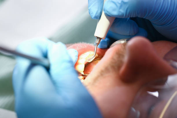 Best Chipped Tooth Repair Near Me  in Carlstadt, NJ