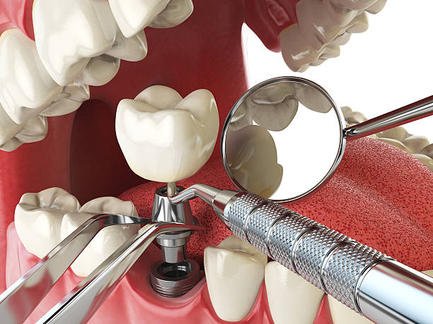 Best Cracked Tooth Emergency Dentist  in Carlstadt, NJ